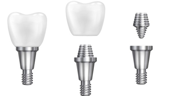 Türk Malı Implant